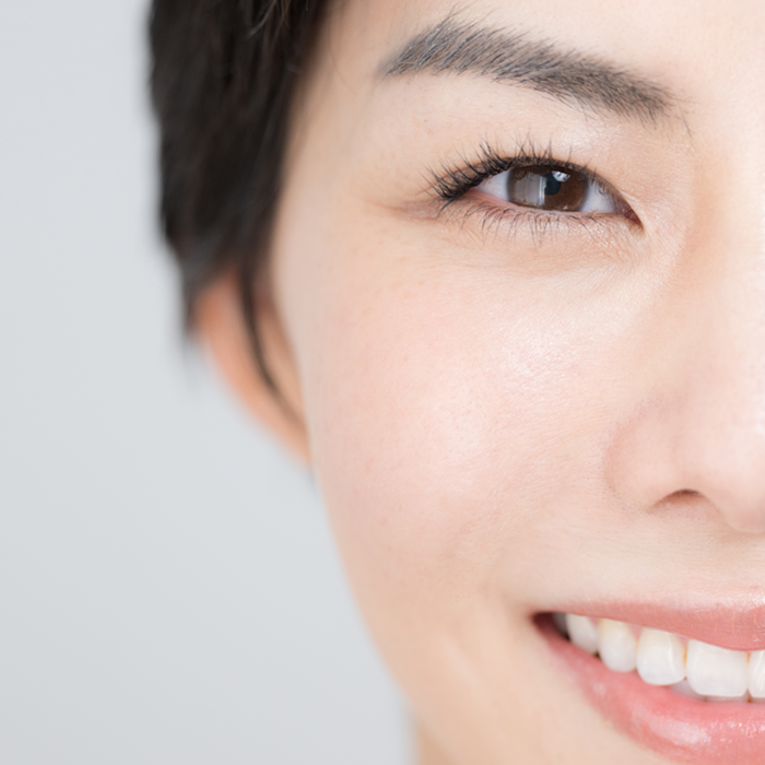 Can under-eye fat return after lower bl... Thumbnail
