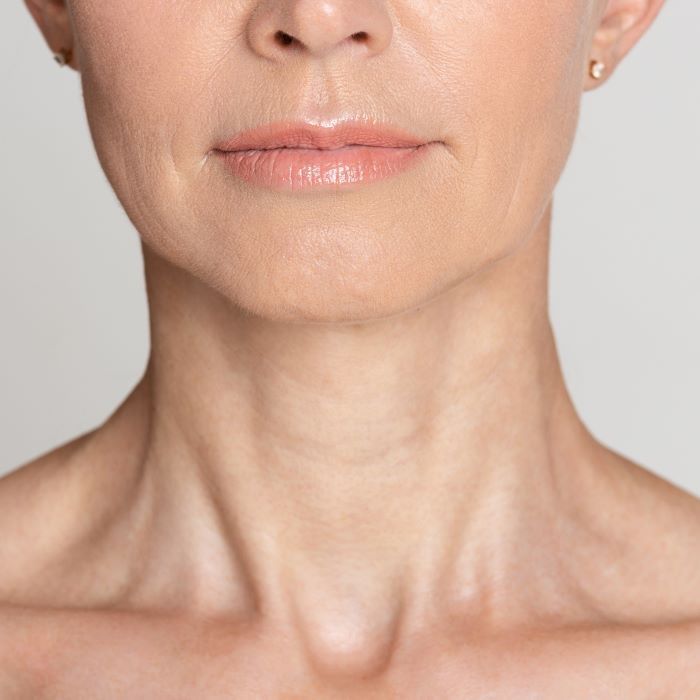 Как улушить морщины на шее Thumbnail